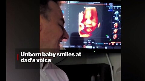 32 Week old Unborn BABY Smiles 💖 in the Womb Smiles to Daddy’s Voice, Captured on Ultrasound!