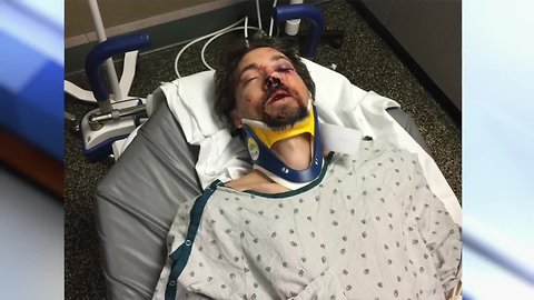 Woman whose husband was beaten in Cheektowaga road rage incident speaks