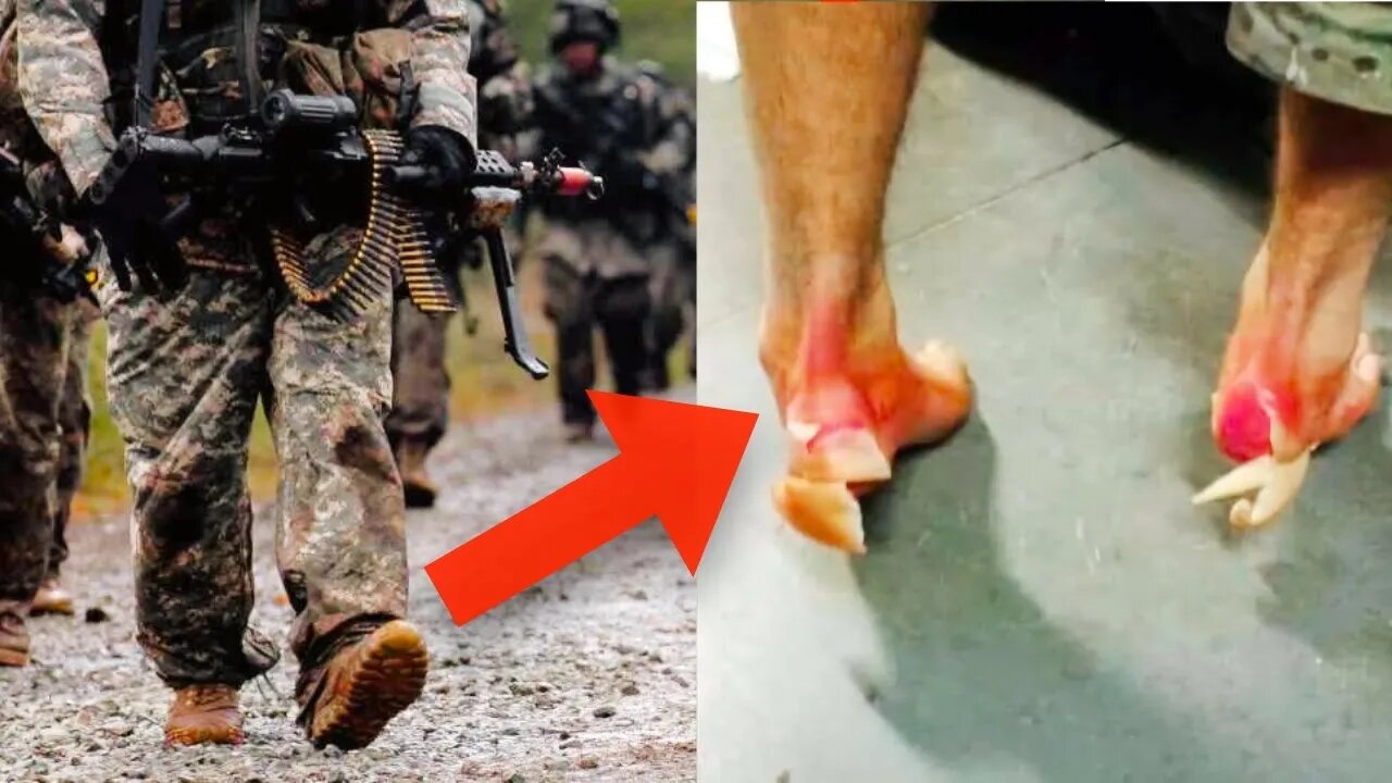 Ruck Marches - How to Prevent Foot Injuries