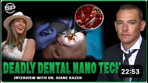 SHOCK CLAIM: Dental Anesthetic POISONED With Nano Tech: Graphene Oxide & Hydro Gel Used In Dentistry