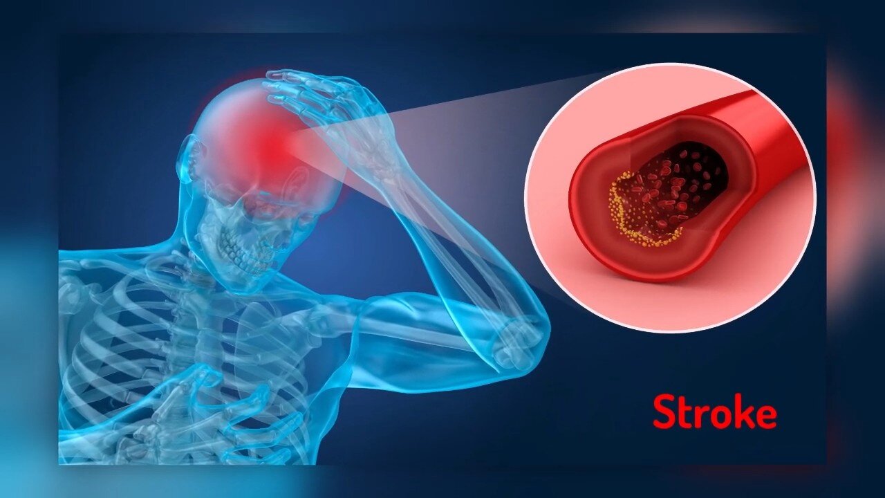 Stroke Supportive Frequency Healing - Energy/Frequency Healing Music