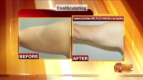 Reduce Stubborn Fat at a "Center of Excellence"