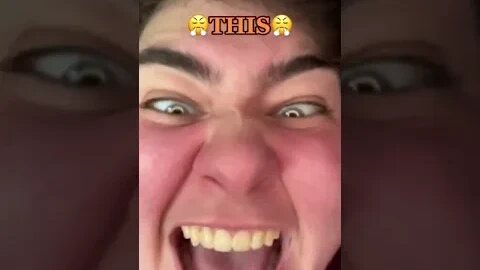 Fuzzz99 Went Viral For Wrong Reason #Shorts