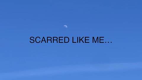 Scarred Like Me