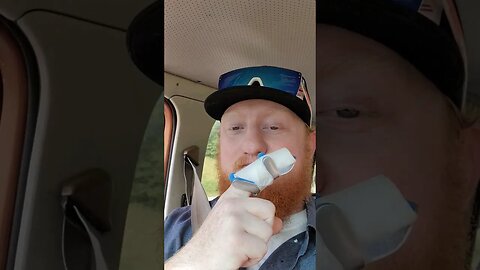 I broke my finger... and stitches!!! 🥲 #vlog #ER #carguys #life #lifehacks