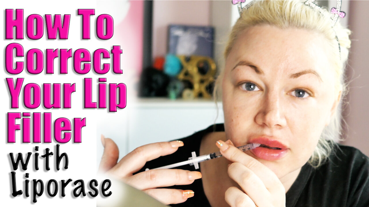 How to Correct Lip Filler with Liporase | Code Jessica10 saves you $$$