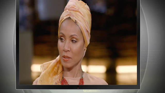 Actress sharing Alopecia experience is empowering others