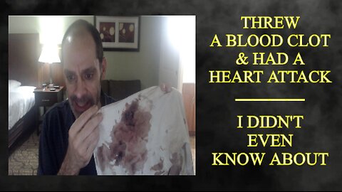 I Had A Heart Attack? WTF?!?! When Stoicism Is A Bad Thing