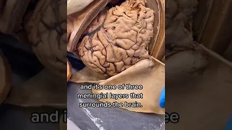 The Layers of a Real Human Head