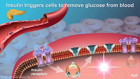 Understanding Type 2 Diabetes