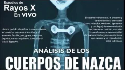 Live and in English! Jaime Maussan's Shocking Alien X-Ray Revealed!