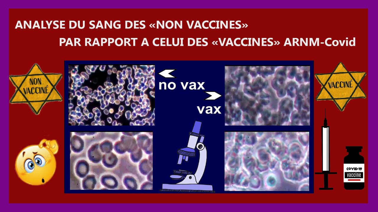 VACCIN Arnm... Your blood before ... and after! Y'a pas photo (Hd 720) Lire descriptif