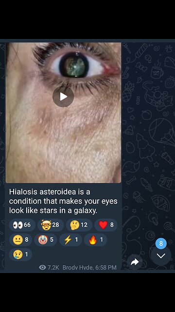 Documentary: Starry Eyes