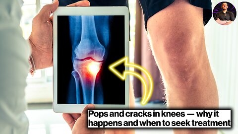 SNAP! Knee Joint Noises Analyzed! When is it Bad Enough to Go to the Doctor?