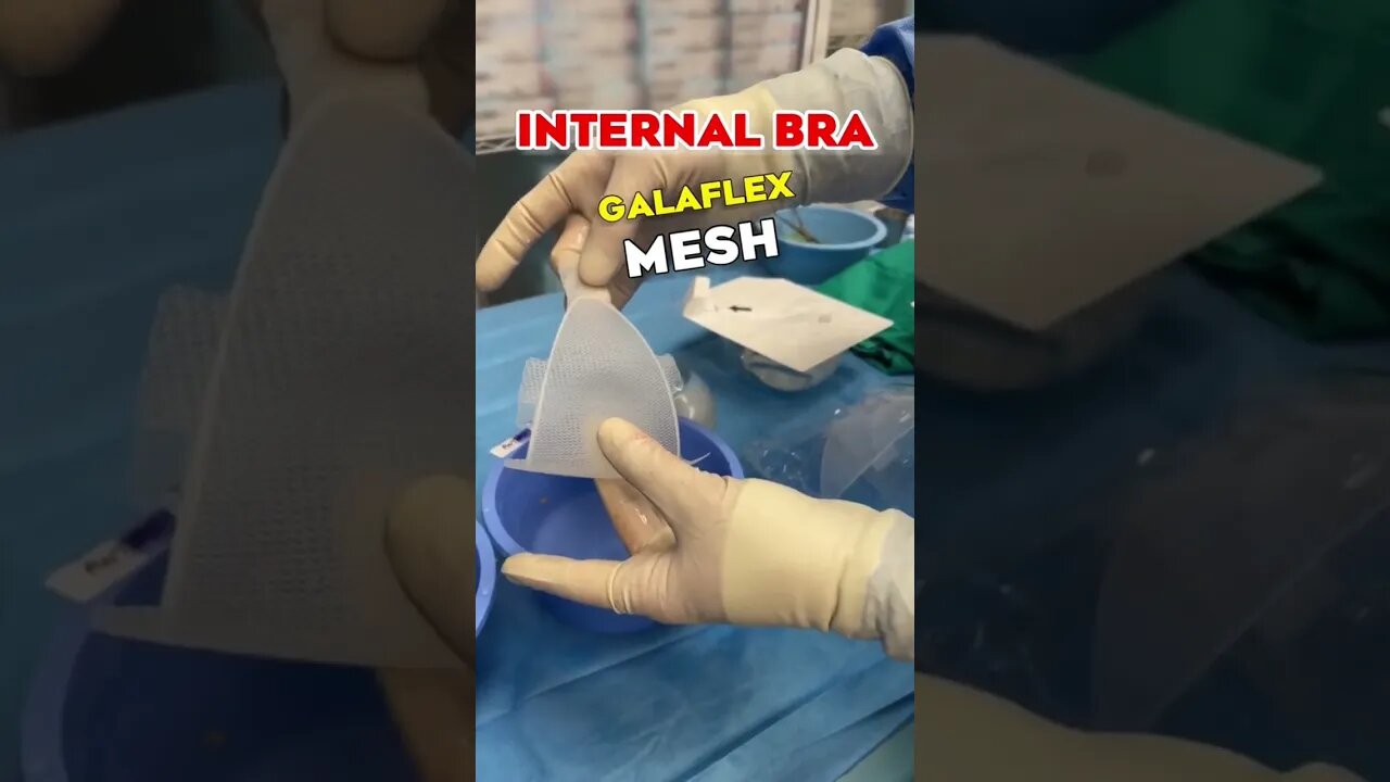 Internal Bras Use Scar Tissue to Support Breasts 🤯 #shorts