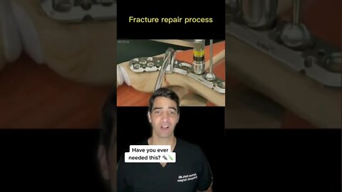 How to Fix a Broken Bone