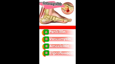 Osteomyelitis question answers mcqs #Osteomyelitis #bone #disease