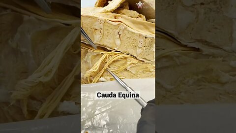 A REAL Human Spinal Cord & Herniated Discs | #shorts #spinalcord