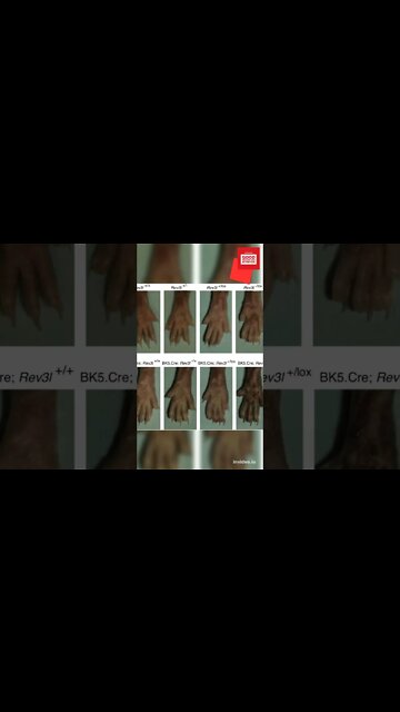 Here are 8 signs and symptoms of vitamin D deficiency.#shorts