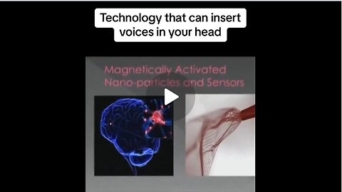 The Government Can Put Voices In Your Head, Rewire Your Thought Processes AND Bypass Your Free-Will