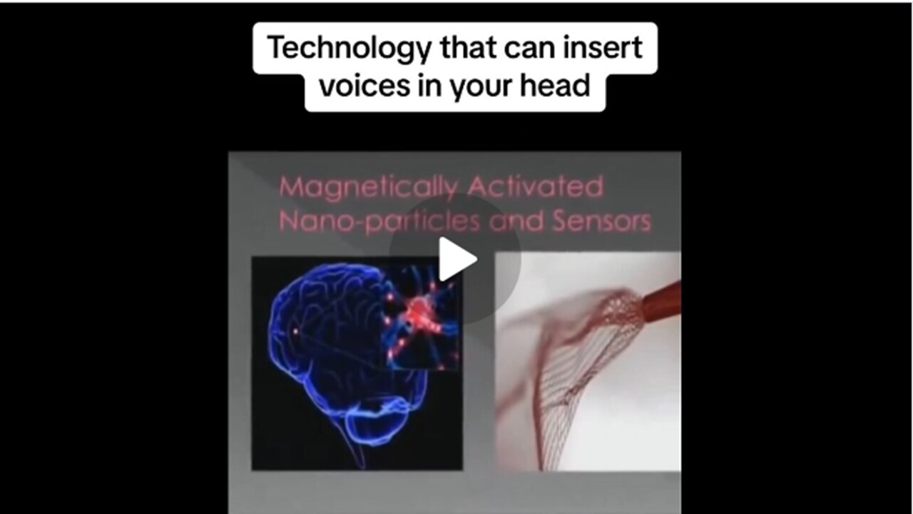 The Government Can Put Voices In Your Head, Rewire Your Thought Processes AND Bypass Your Free-Will