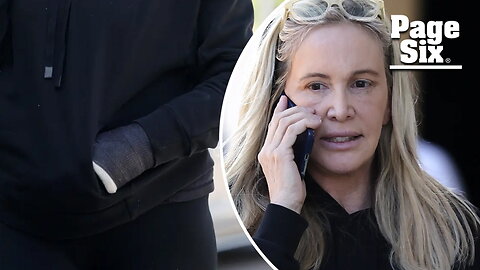Shannon Beador spotted with arm cast, facial bruising after entering outpatient program