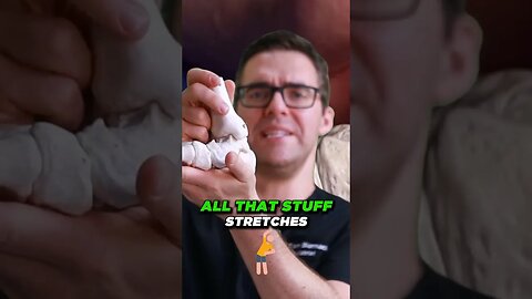 What is Overpronation? [Fix Flat Feet Pain FOREVER!]