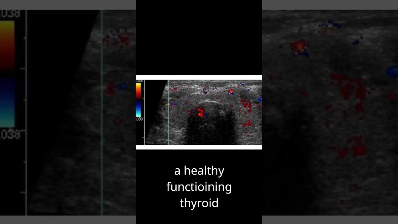 How to repair thyroid disorders?