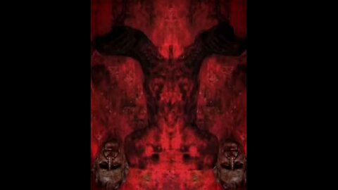 Charles Prince of Wales and 'Sanguine Vampiris' disease. Tavistock, MK Ultra.