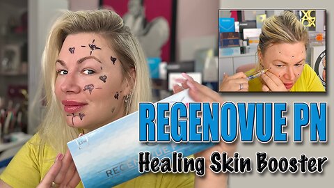 Regenovue PN, Healing Skin Booster w/ Modified BAP Technique! AceCosm.com, code Jessica10 Saves