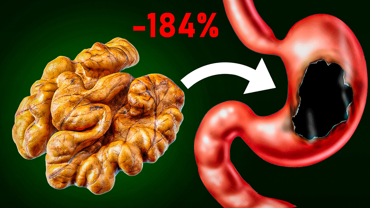 Walnuts are Highly Contraindicated for These People. What do Walnuts do?