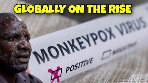 MONKEY POX IS ON THE RISE WORLD HEALTH ORGANIZATION DECLARING LOCKDOWNS