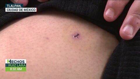 ¿Quién es responsable si te ataca un perro con dueño? ¡Depende de las lesiones, esto puedes hacer!