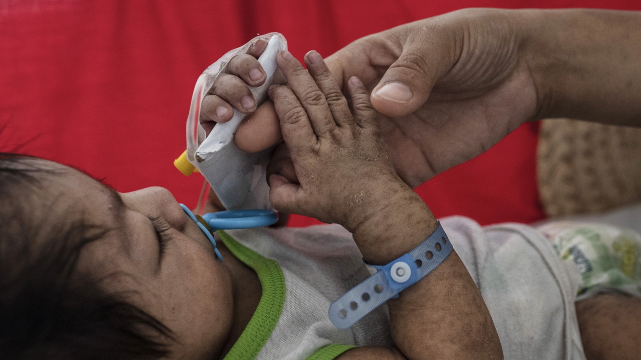 Measles Found To Leave Children's Immune Systems Vulnerable
