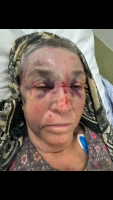 82 year old Muslim lady was beaten up in Netherlands ⏬Read description