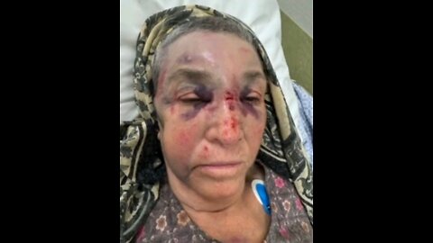 82 year old Muslim lady was beaten up in Netherlands ⏬Read description