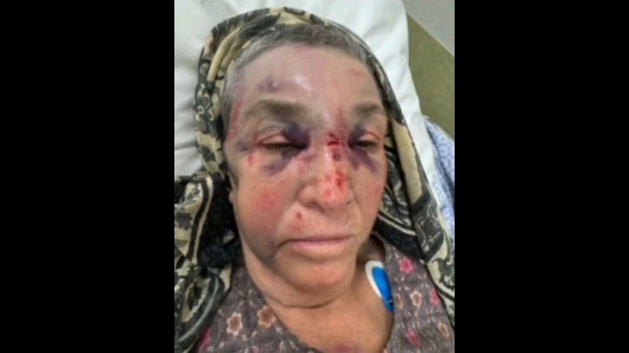 82 year old Muslim lady was beaten up in Netherlands ⏬Read description
