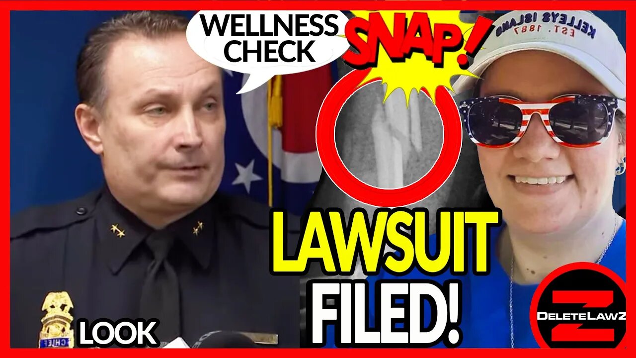 Toledo, Ohio #Cops Snap Gloria Sauerwein's arm on a "Wellness Check"- She's not OK! #Police #Pigs