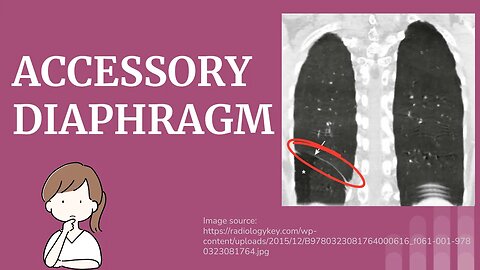 Accessory Diaphragm (Duplicated Diaphragm) Explained | Novice Medic