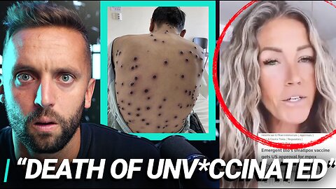 Monkey Pox: BEWARE of their Lethal "Solution" | Kap Reacts
