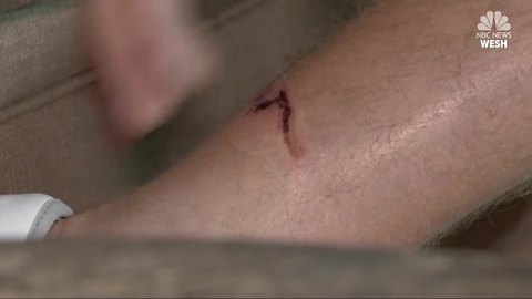 'This is how I'm dying': Hunter recalls bear attack that killed guide in Wyoming