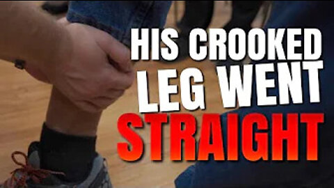 A CREATIVE MIRACLE HAPPENED! HIS CROOKED LEG WENT STRAIGHT!😱