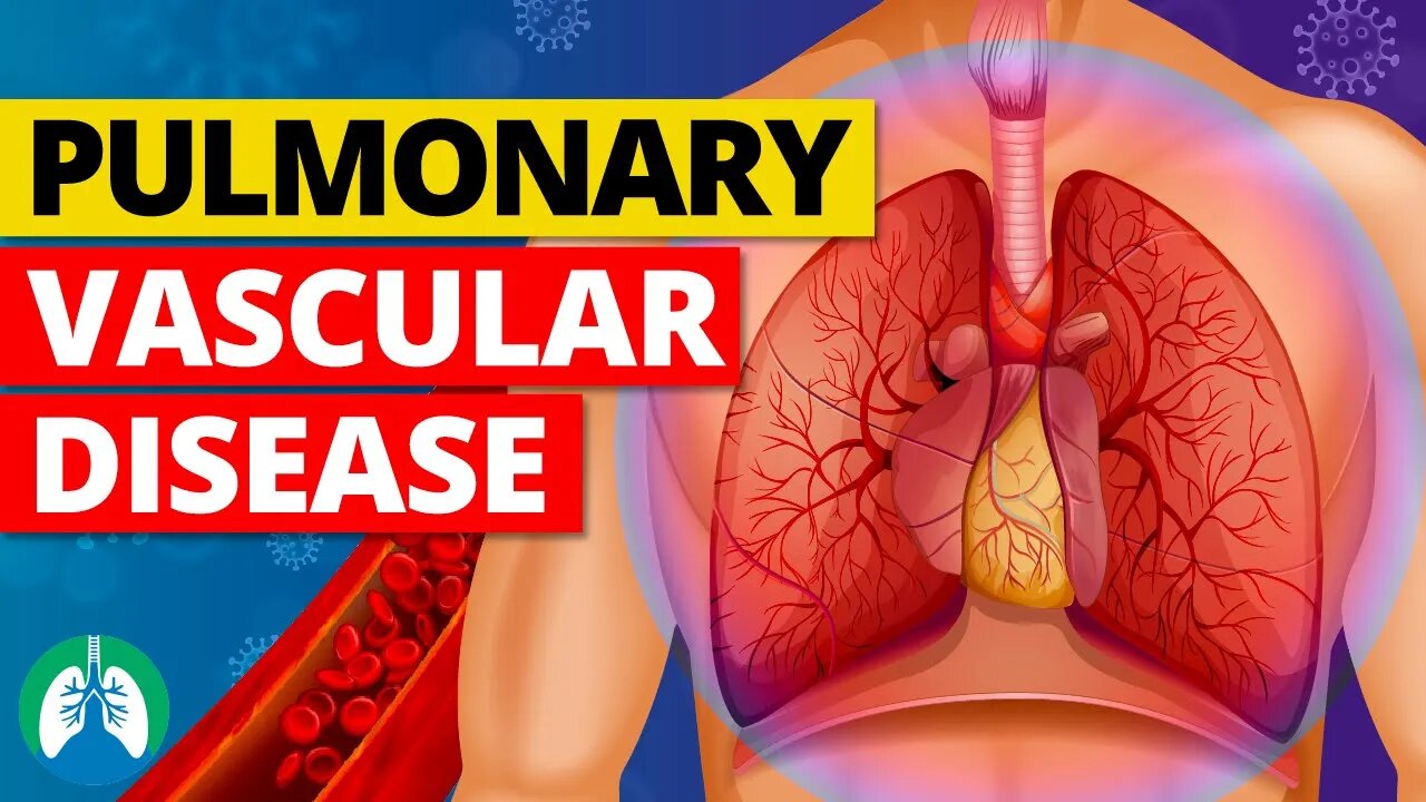 Pulmonary Vascular Disease (Medical Definition) | Quick Explainer Video