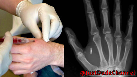 The FDA Approved Microchips In Humans In 2004