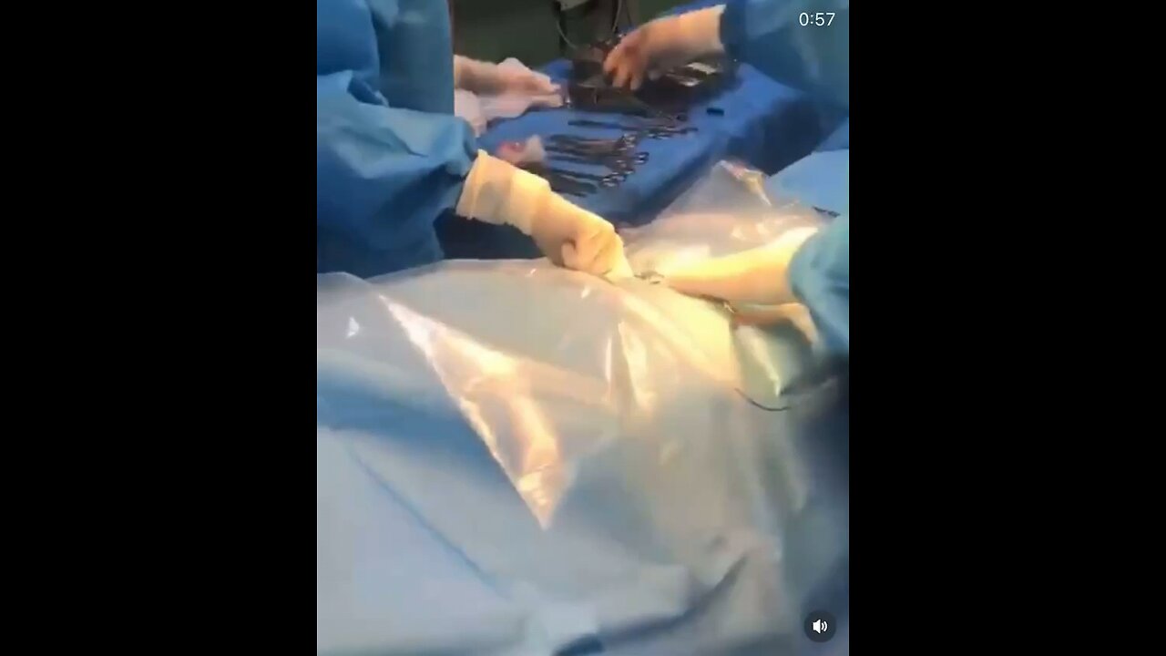 The moment of Liam's birth