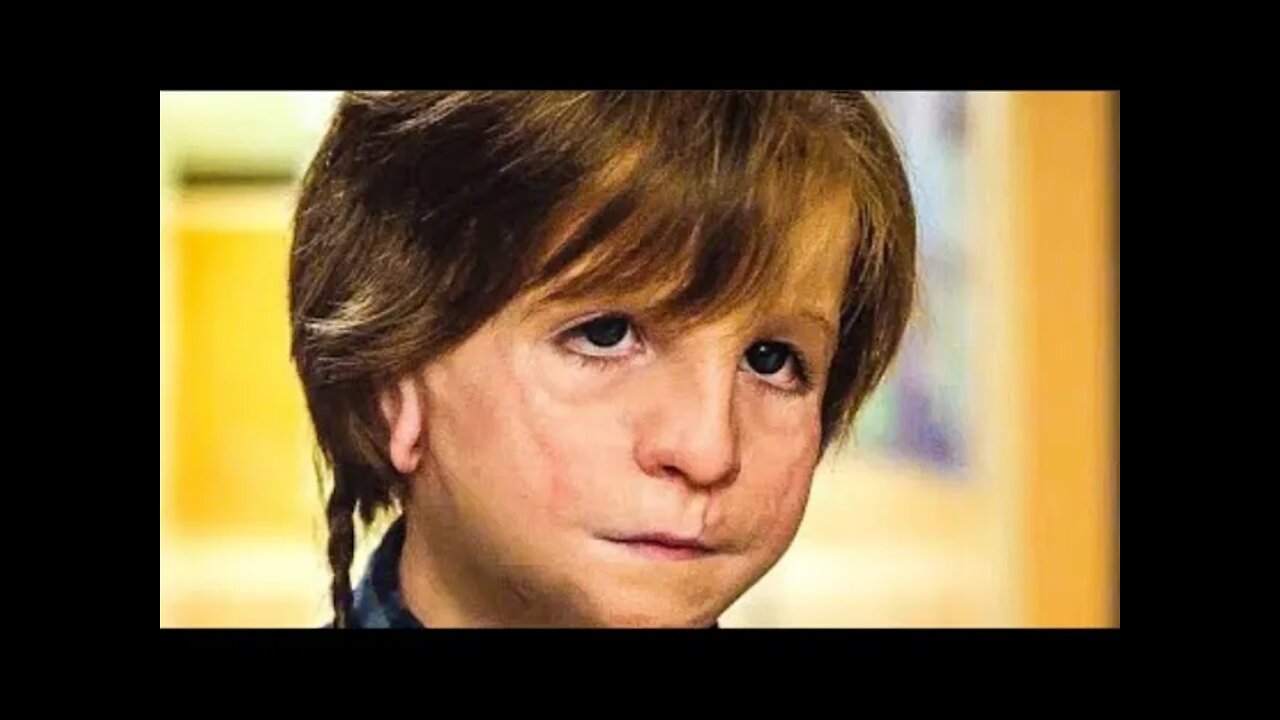 Abnormal Boy Proves The Real Definition Of Don't Judge Book By Its Cover