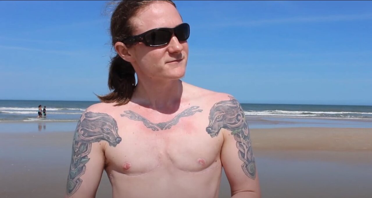 FtM 2 years on Testosterone, 1 year post-op Top Surgery