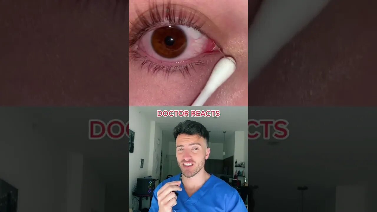 Your "Eye Strings" Explained
