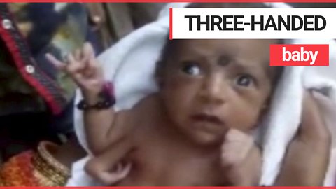 Baby being worshipped as god after being born with three hands