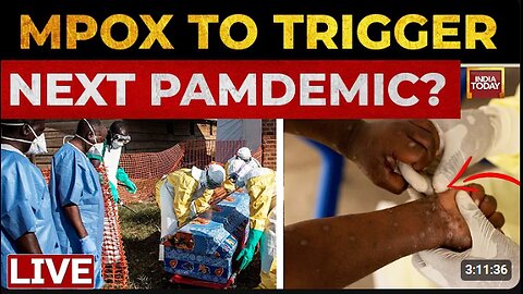 Monkeypox Hoax: Conspiracy theories stir across social media over latest outbreak spreads